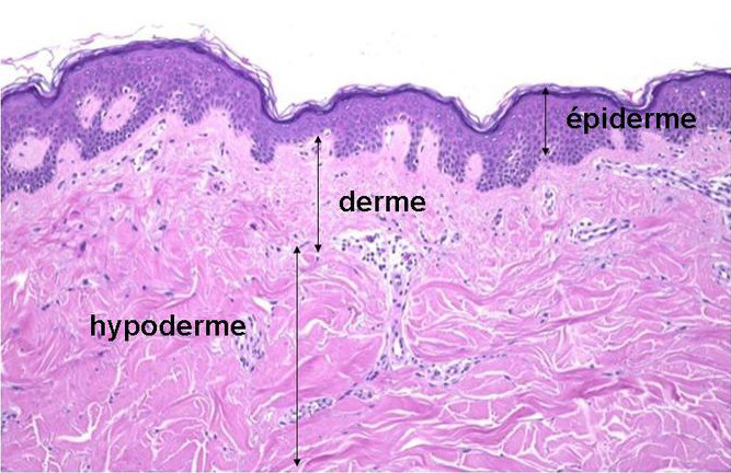 Coupe de peau montrant l'épiderme, le derme et l'hypoderme